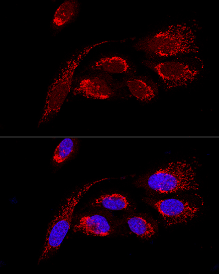 ATP5H Rabbit polyclonal antibody