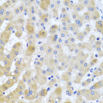 EIF3M Rabbit polyclonal antibody