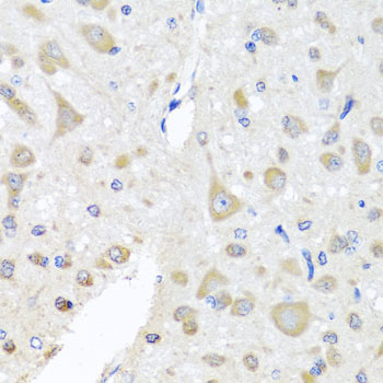 EIF3M Rabbit polyclonal antibody