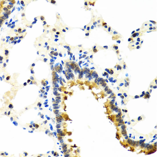 CRTAP Rabbit polyclonal antibody