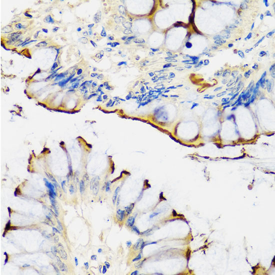 CRTAP Rabbit polyclonal antibody