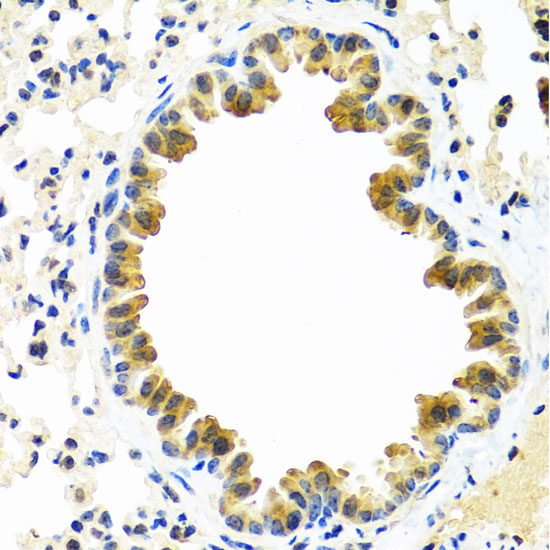 CRTAP Rabbit polyclonal antibody