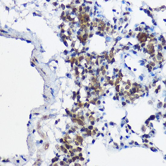 MYBBP1A Rabbit polyclonal antibody