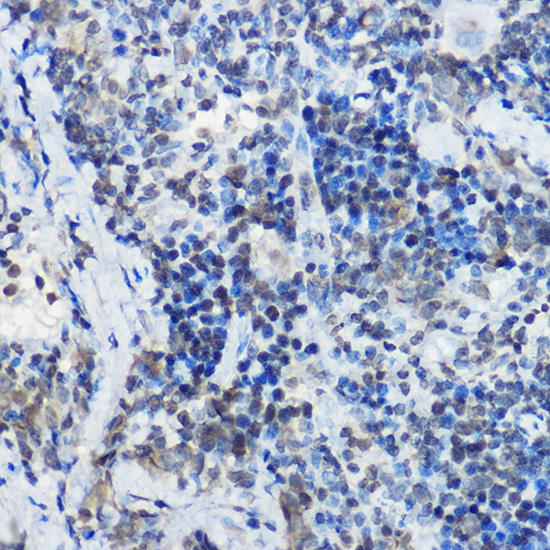 MYBBP1A Rabbit polyclonal antibody
