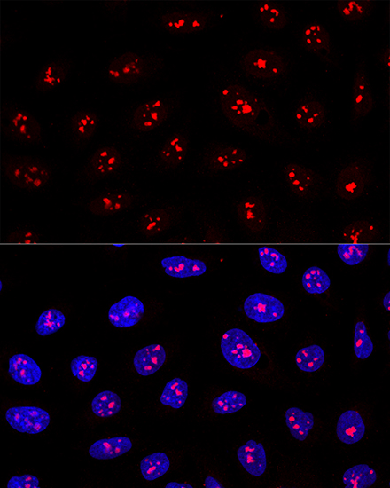 MYBBP1A Rabbit polyclonal antibody