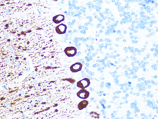 IP3R Rabbit monoclonal antibody