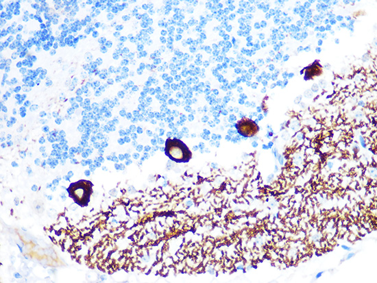 IP3R Rabbit monoclonal antibody