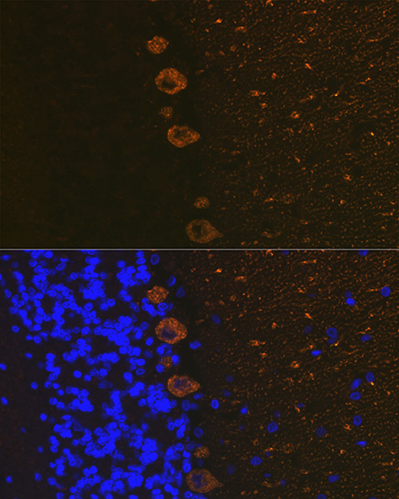 IP3R Rabbit monoclonal antibody