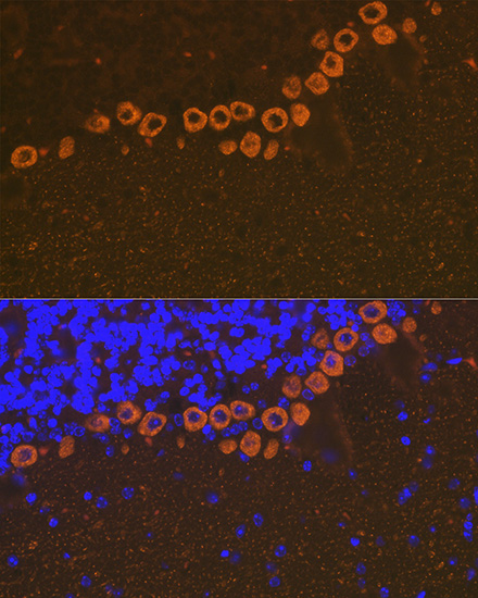 IP3R Rabbit monoclonal antibody
