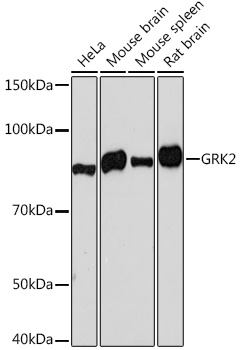 [KO Validated] GRK2 Rabbit monoclonal antibody