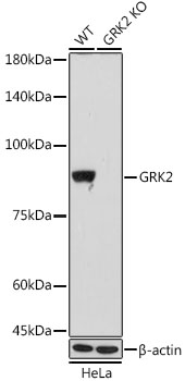 [KO Validated] GRK2 Rabbit monoclonal antibody