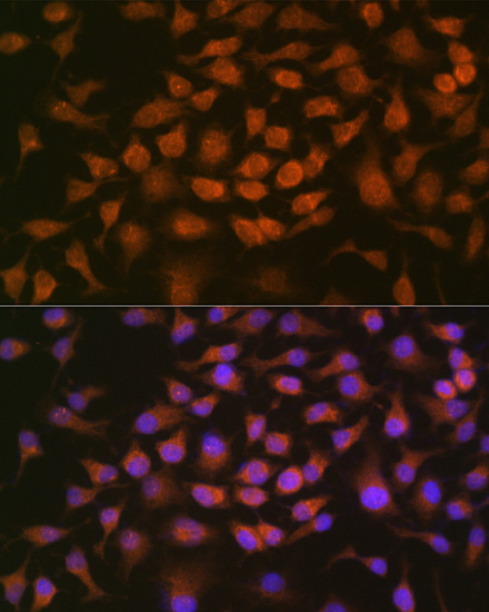 [KO Validated] GRK2 Rabbit monoclonal antibody