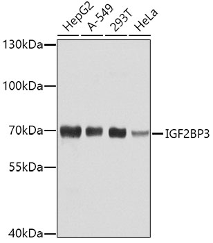 IGF2BP3 Rabbit polyclonal antibody