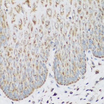 IGF2BP3 Rabbit polyclonal antibody
