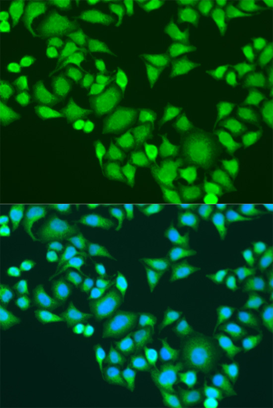 IGF2BP3 Rabbit polyclonal antibody