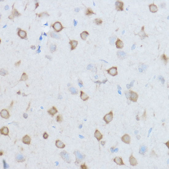 CCT8 Rabbit polyclonal antibody