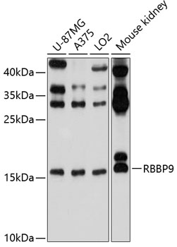 RBBP9 Rabbit polyclonal antibody