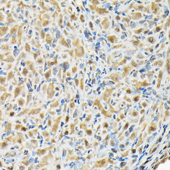 RBBP9 Rabbit polyclonal antibody