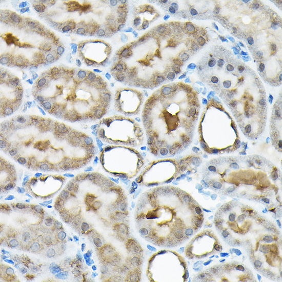 RBBP9 Rabbit polyclonal antibody