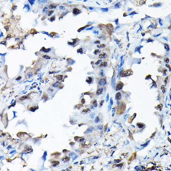 RBBP9 Rabbit polyclonal antibody