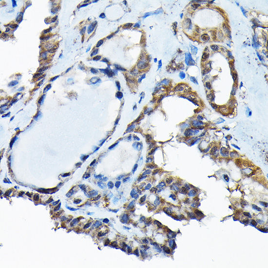 RBBP9 Rabbit polyclonal antibody