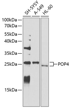 POP4 Rabbit polyclonal antibody