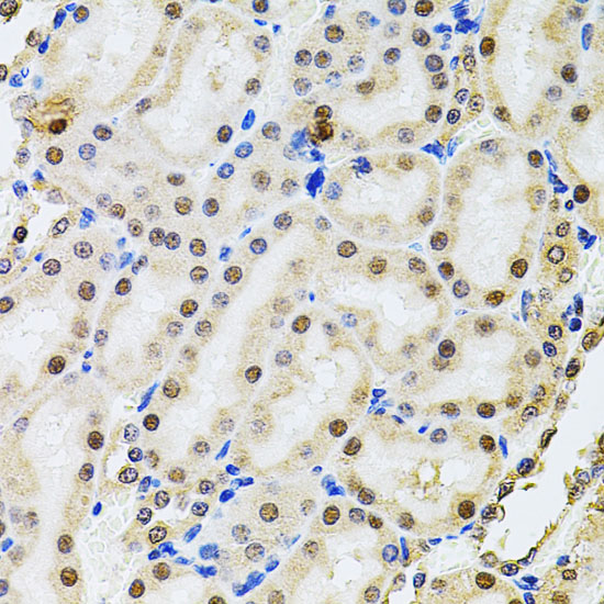 POP4 Rabbit polyclonal antibody