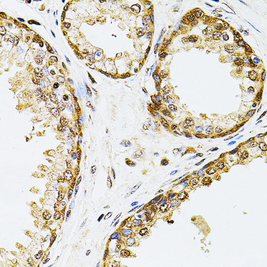 POP4 Rabbit polyclonal antibody