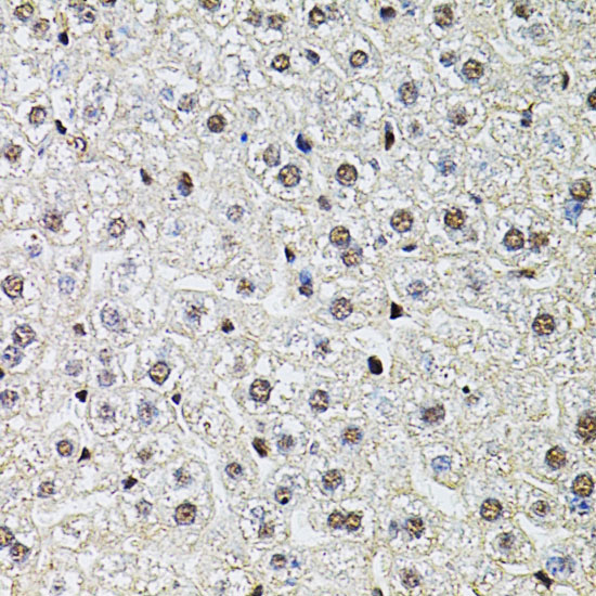 POP4 Rabbit polyclonal antibody