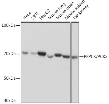 [KO Validated] PEPCK/PCK2 Rabbit monoclonal antibody