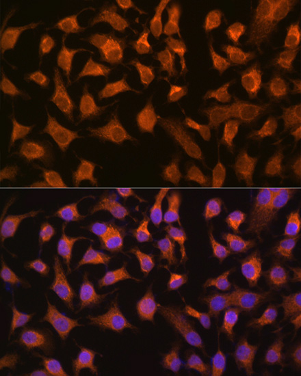[KO Validated] PEPCK/PCK2 Rabbit monoclonal antibody