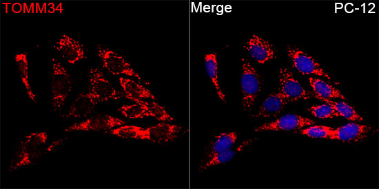 TOMM34 Rabbit polyclonal antibody