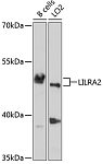 Western blot - LILRA2 Rabbit pAb (A4477)