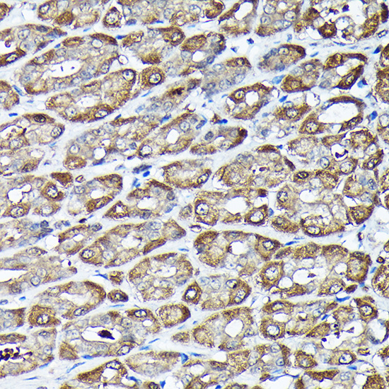 ADRM1 Rabbit polyclonal antibody