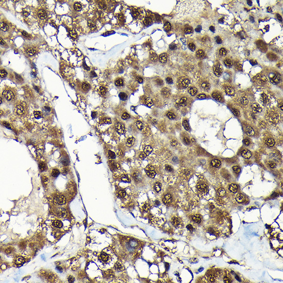 ADRM1 Rabbit polyclonal antibody