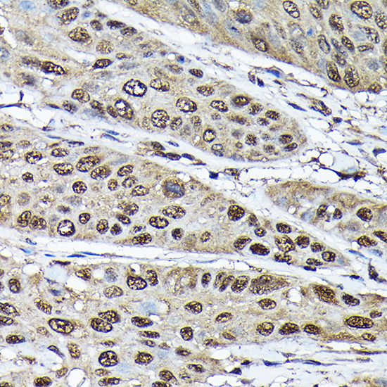 ADRM1 Rabbit polyclonal antibody