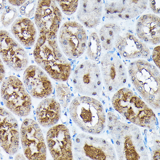 ADRM1 Rabbit polyclonal antibody