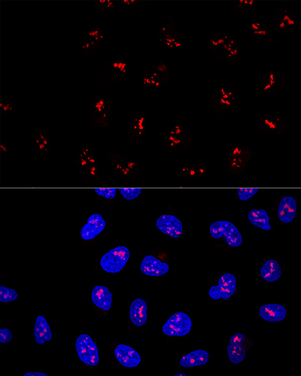 KRR1 Rabbit polyclonal antibody