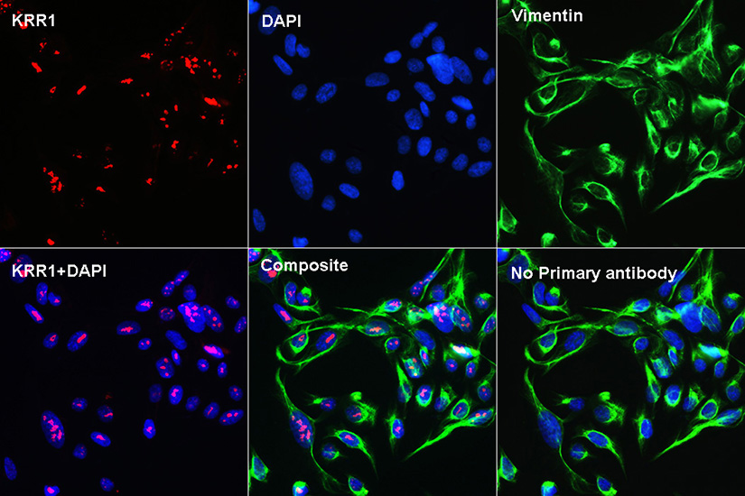 KRR1 Rabbit polyclonal antibody