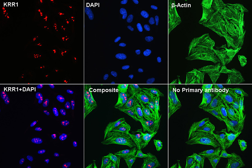 KRR1 Rabbit polyclonal antibody