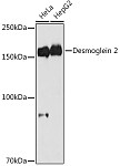 Western blot - Desmoglein 2 Rabbit mAb (A4489)