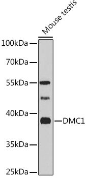 DMC1 Rabbit polyclonal antibody