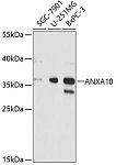 Western blot - ANXA10 Rabbit pAb (A4492)