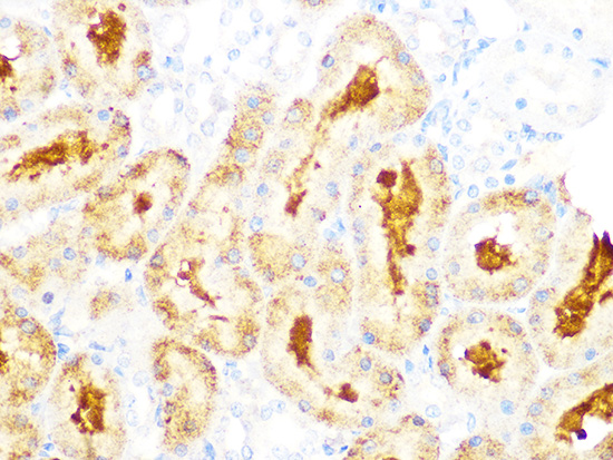 GCLC Rabbit monoclonal antibody