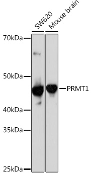 PRMT1 Rabbit monoclonal antibody