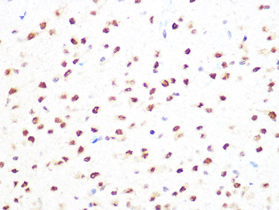 PRMT1 Rabbit monoclonal antibody