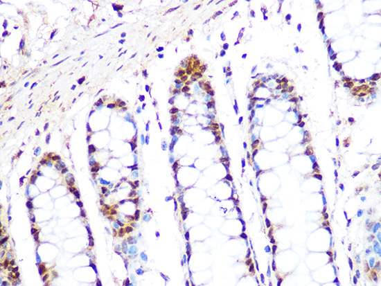 PRMT1 Rabbit monoclonal antibody