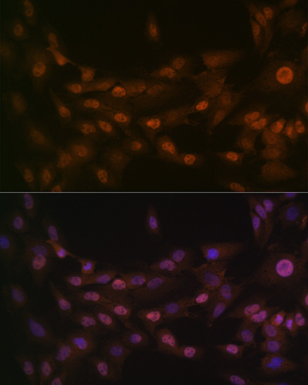 PRMT1 Rabbit monoclonal antibody