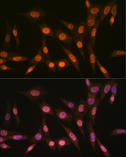 PRMT1 Rabbit monoclonal antibody