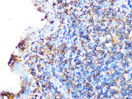 Arp3 Rabbit monoclonal antibody